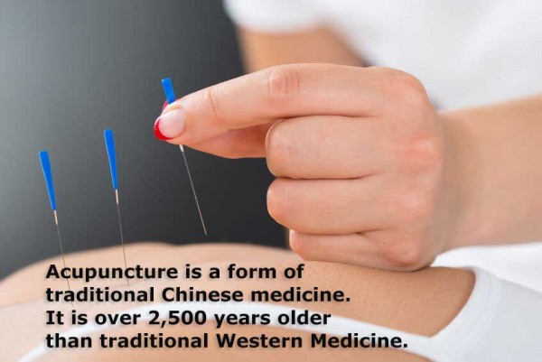 An image of a person applying needles to a person's skin to perform acupuncture and to discuss acupressure vs acupuncture